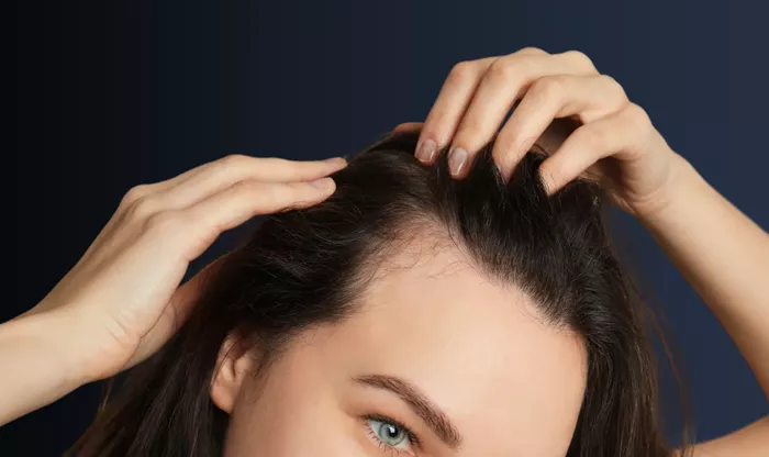 Hair Transplant