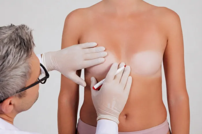 Breast Implants