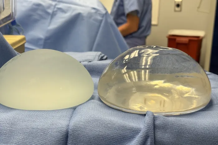 Breast Implants