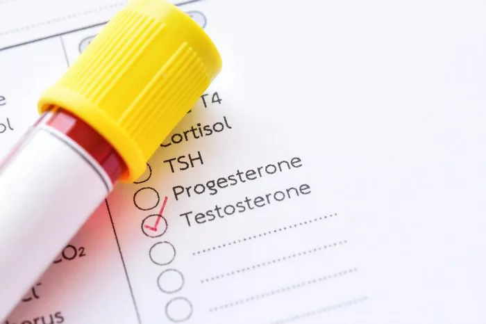 Testosterone