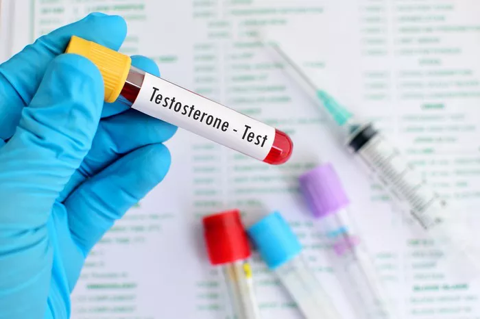 Testosterone