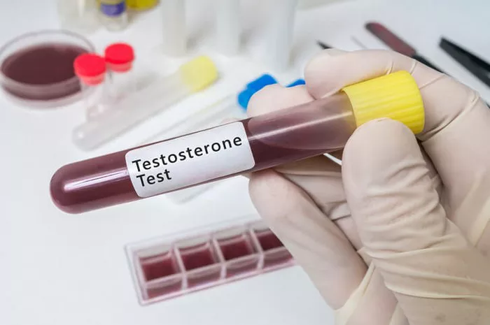 Testosterone